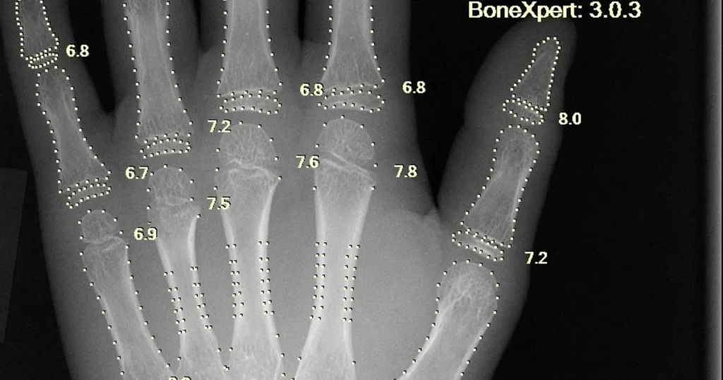 Inteligência Artificial no Diagnóstico Médico