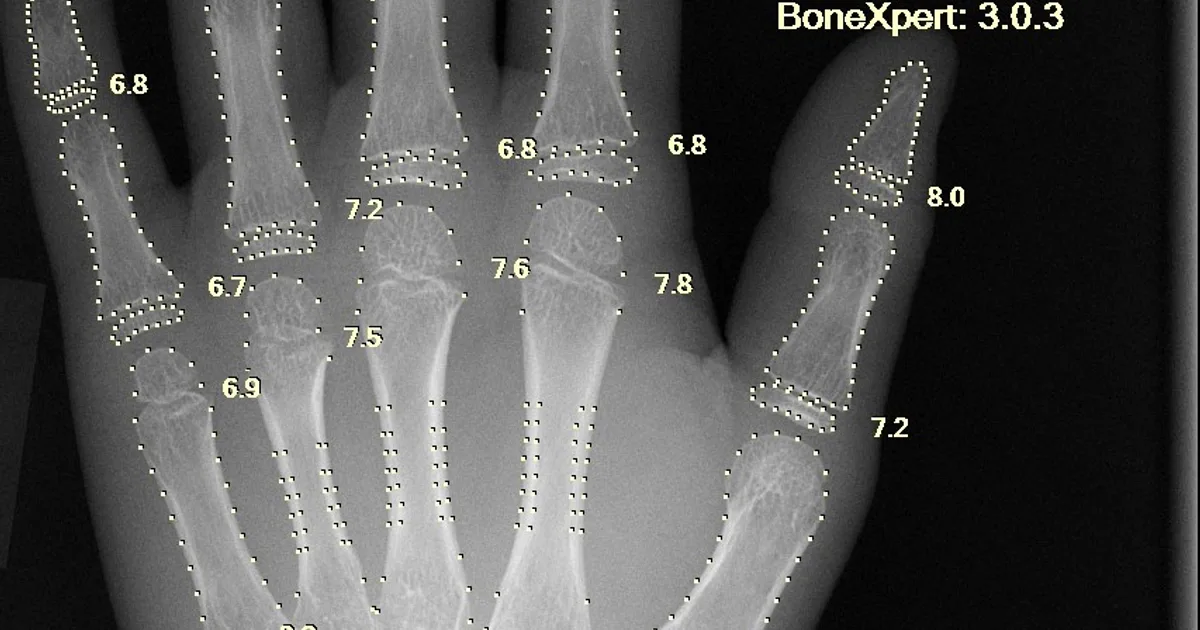 Inteligência Artificial no Diagnóstico Médico
